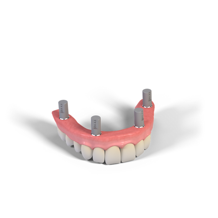 Straumann® RevEX™ Scanbody